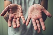 Внимаю населения: О профилактике кори